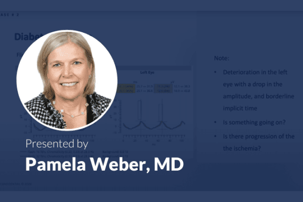 DR case Weber